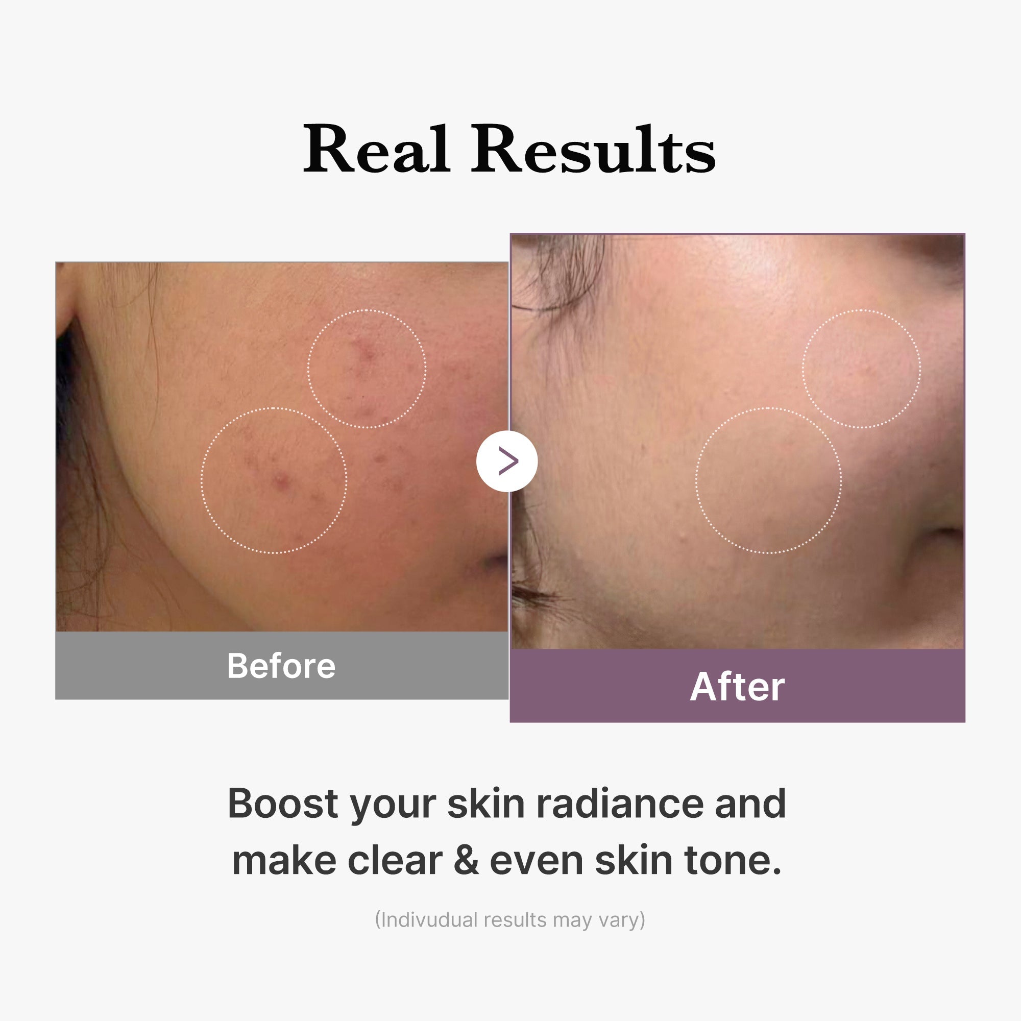 [GIFT] AGE-R Glutathione Glow Milk Toner - medicube.us